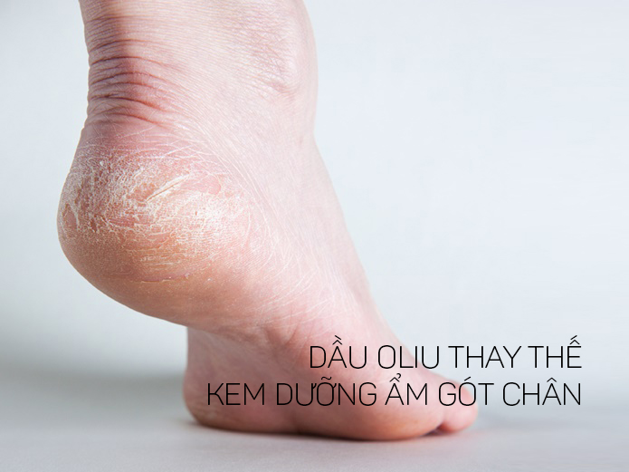 Dưỡng ẩm gót chân với dầu ô liu