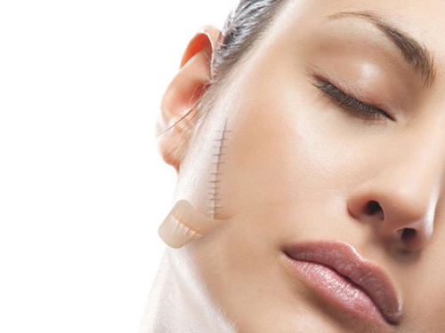 Dầu nụ tầm xuân điều trị sẹo